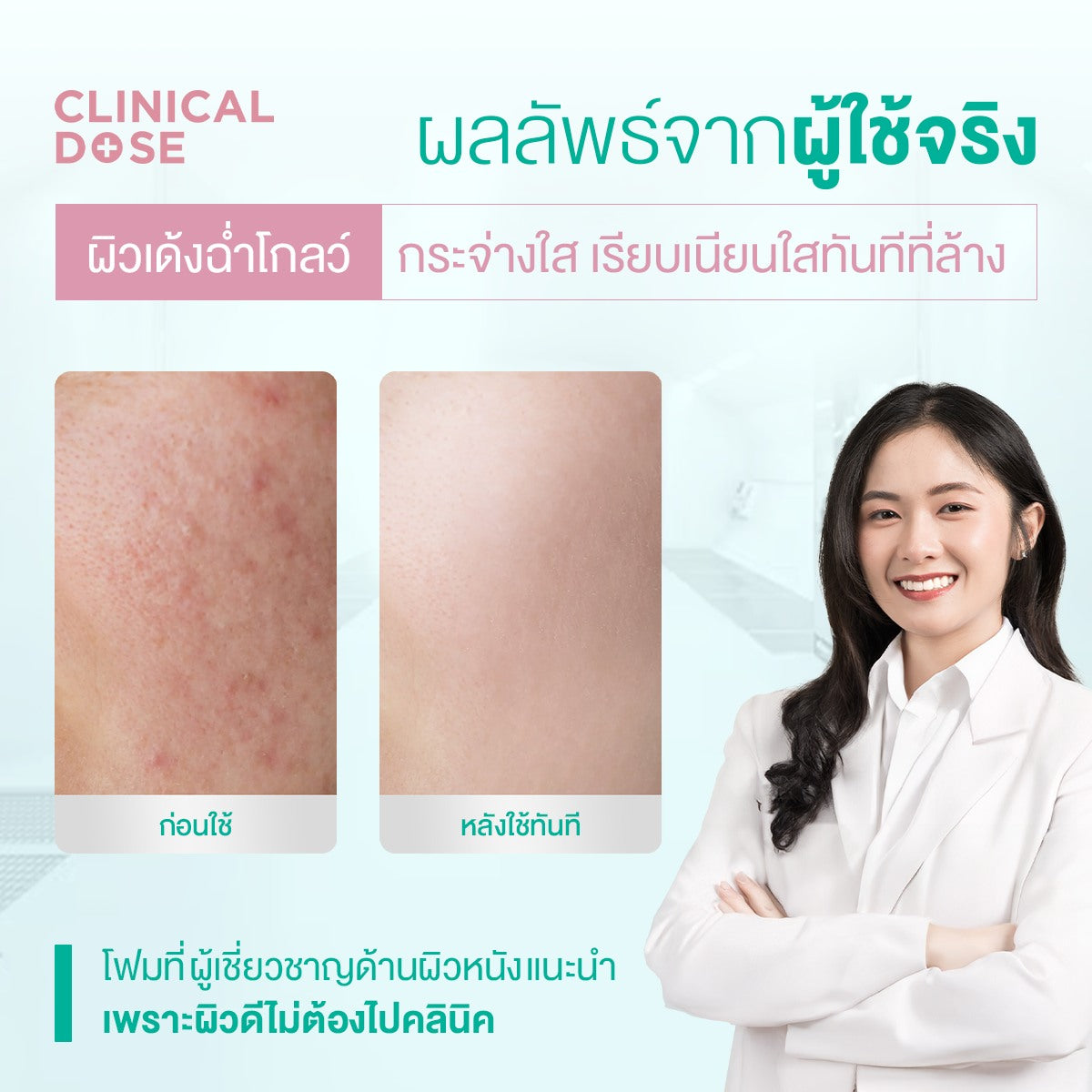 Smooth E White Babyface Spot Clear