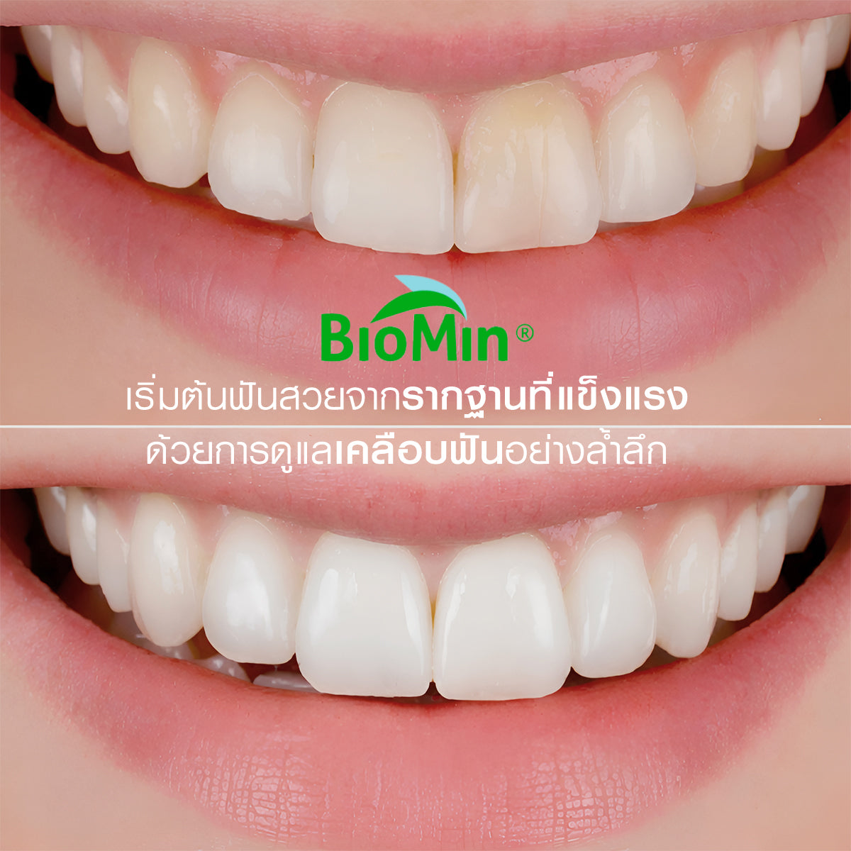 Dentiste' Repaire-ReX3 70g. เซรั่มฟัน+ยาสีฟัน 2in1 เพิ่มเนื้อผิวฟันให้แข็งแรง ป้องกันฟันผุ ฟรี Magic Brush x2