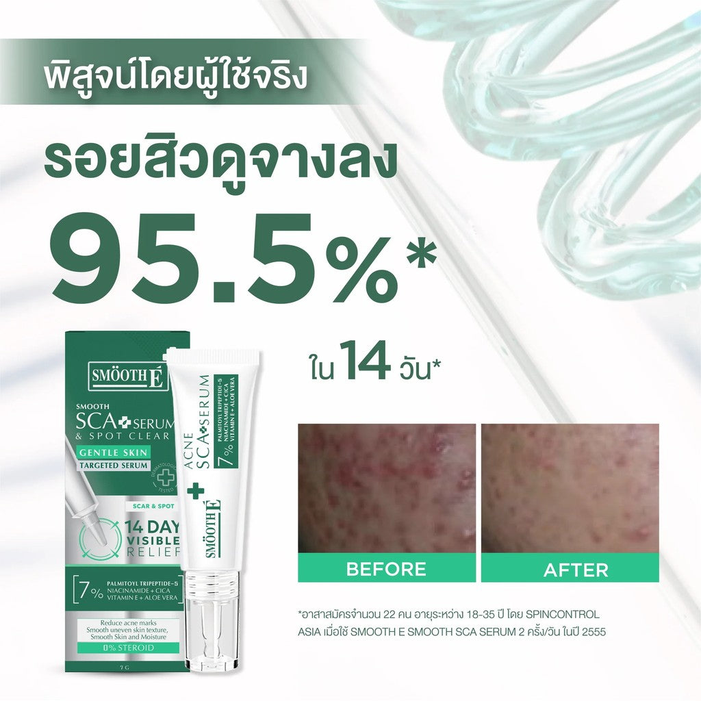 Smooth E SMOOTH SCA SERUM 7 GM.