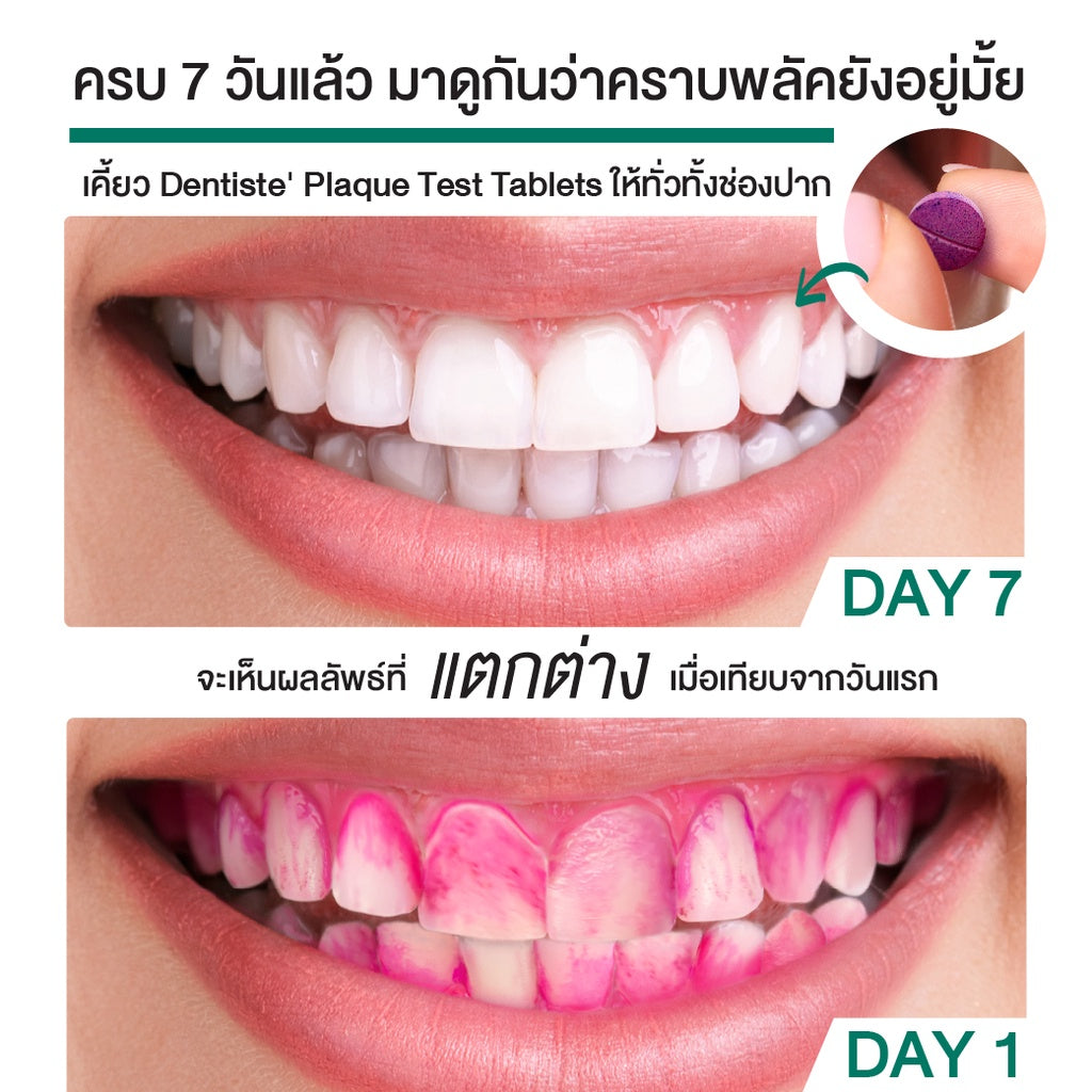 Dentiste' PLAQUE TEST TABLETS 10'S