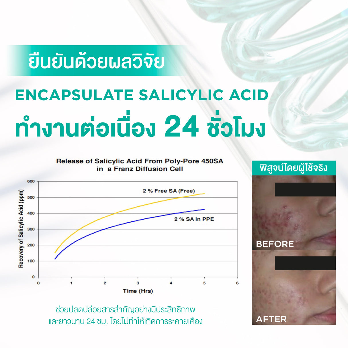 Smooth E Acne-5 Rapid Action Plus