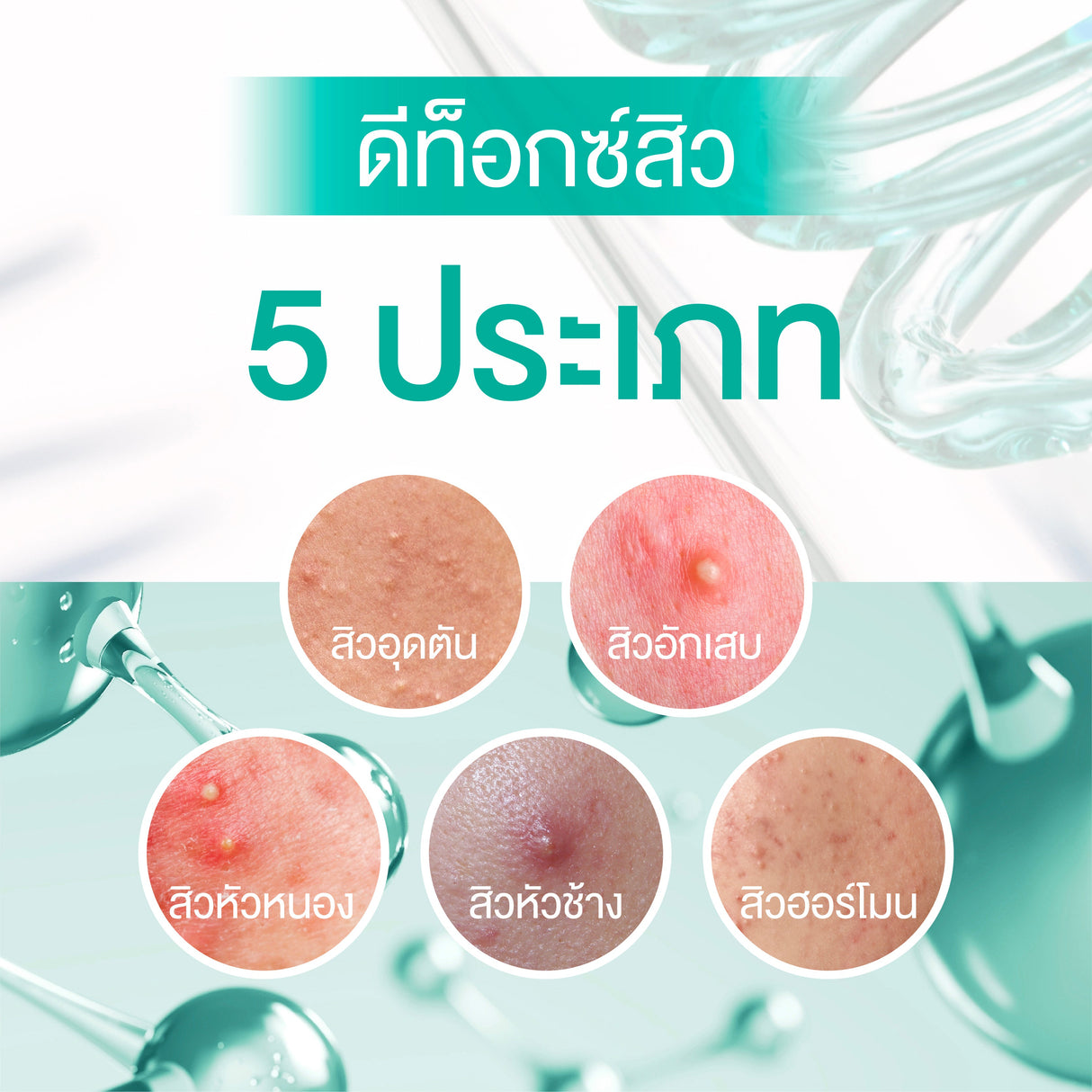 Smooth E Acne-5 Rapid Action