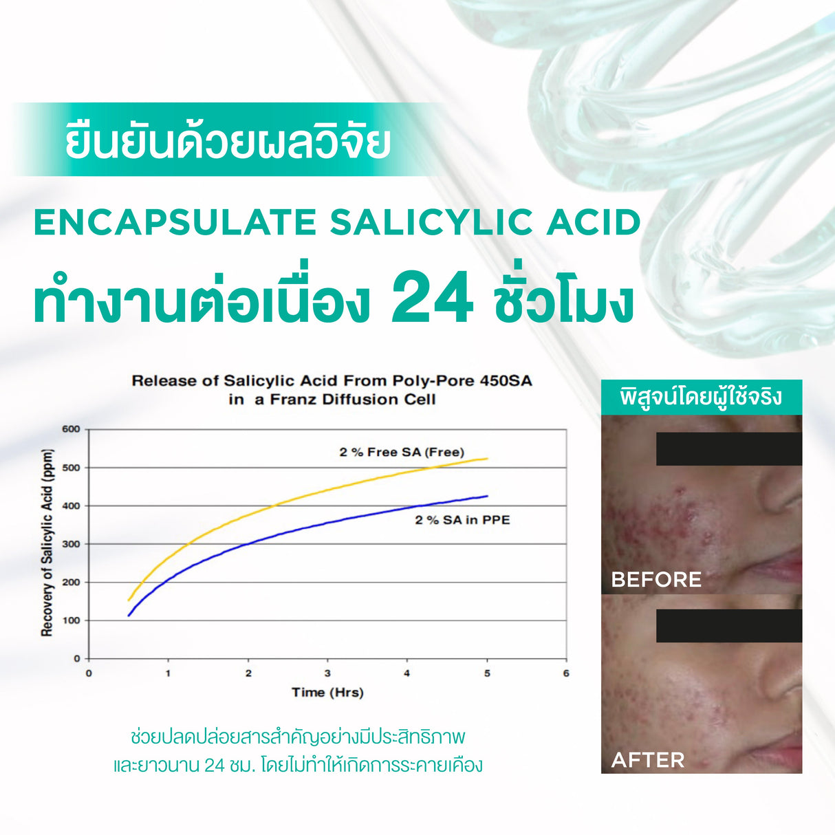 Smooth E Acne-5 Rapid Action