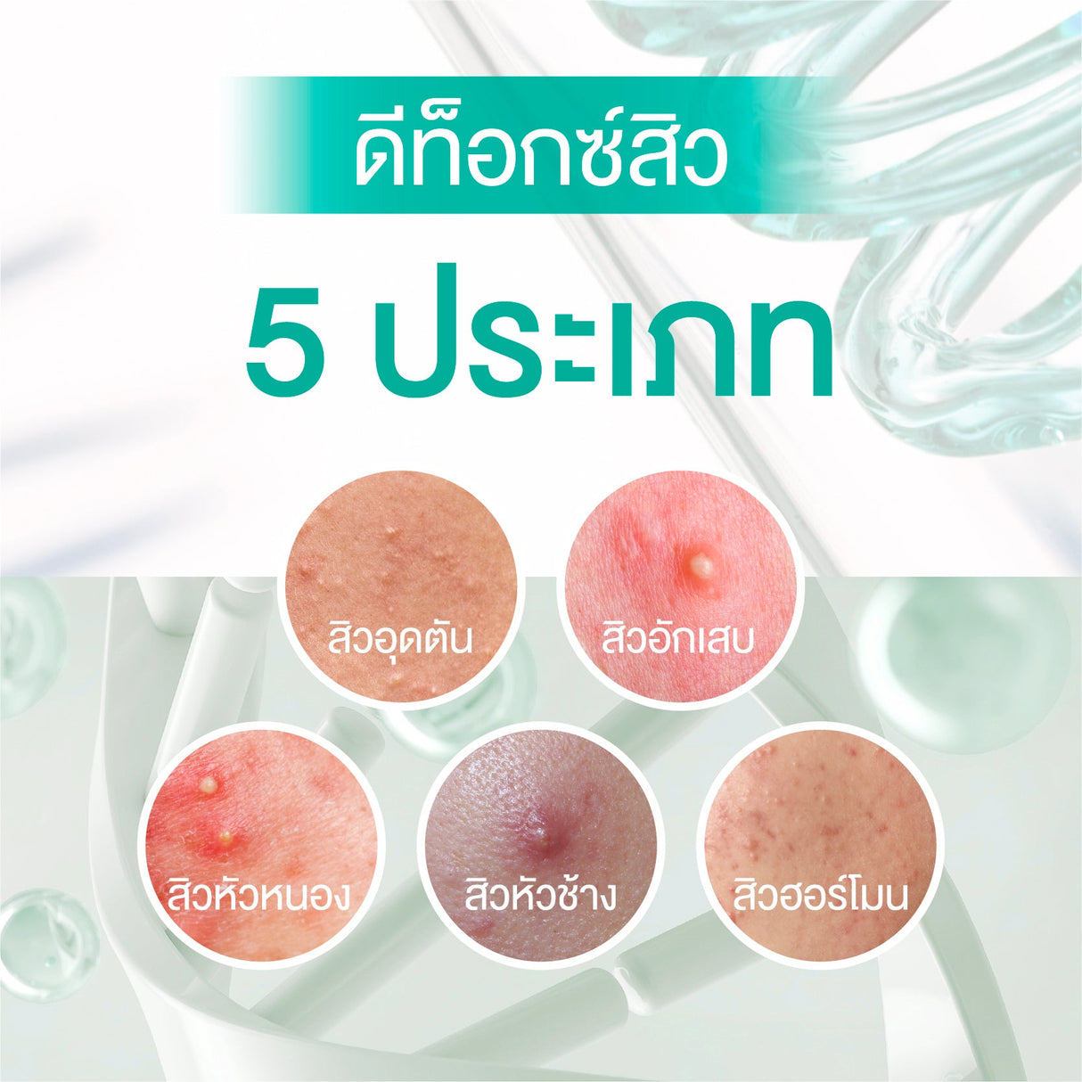 Smooth E Babyface Acne-5 Detoxify Non-Ionic Foam