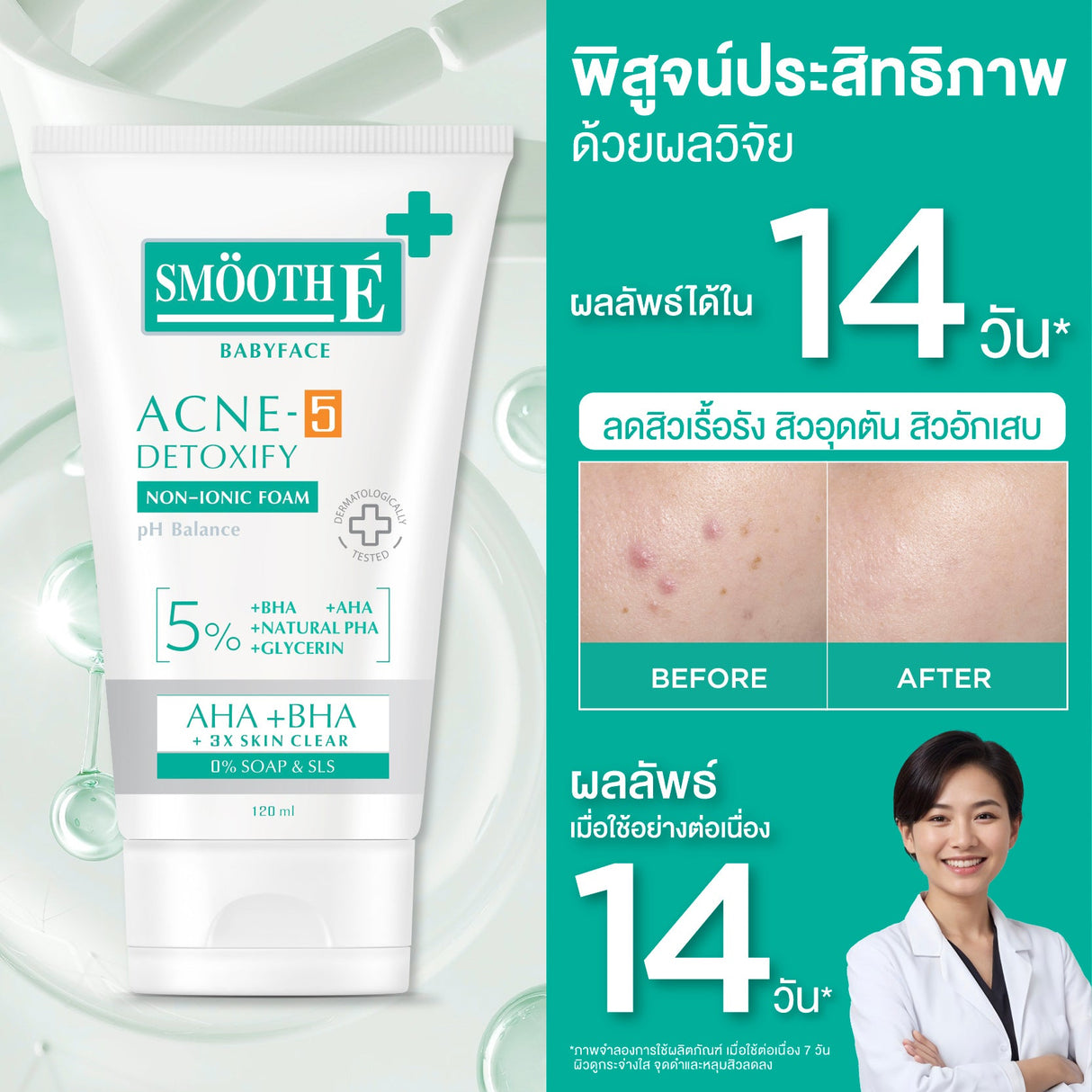 Smooth E Babyface Acne-5 Detoxify Non-Ionic Foam