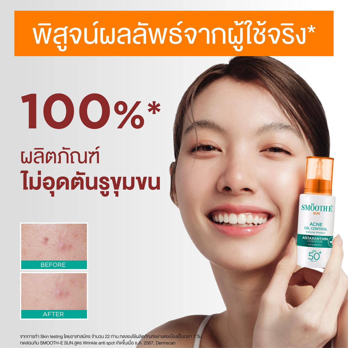 Smooth E Sun Asta Acne Oil Control