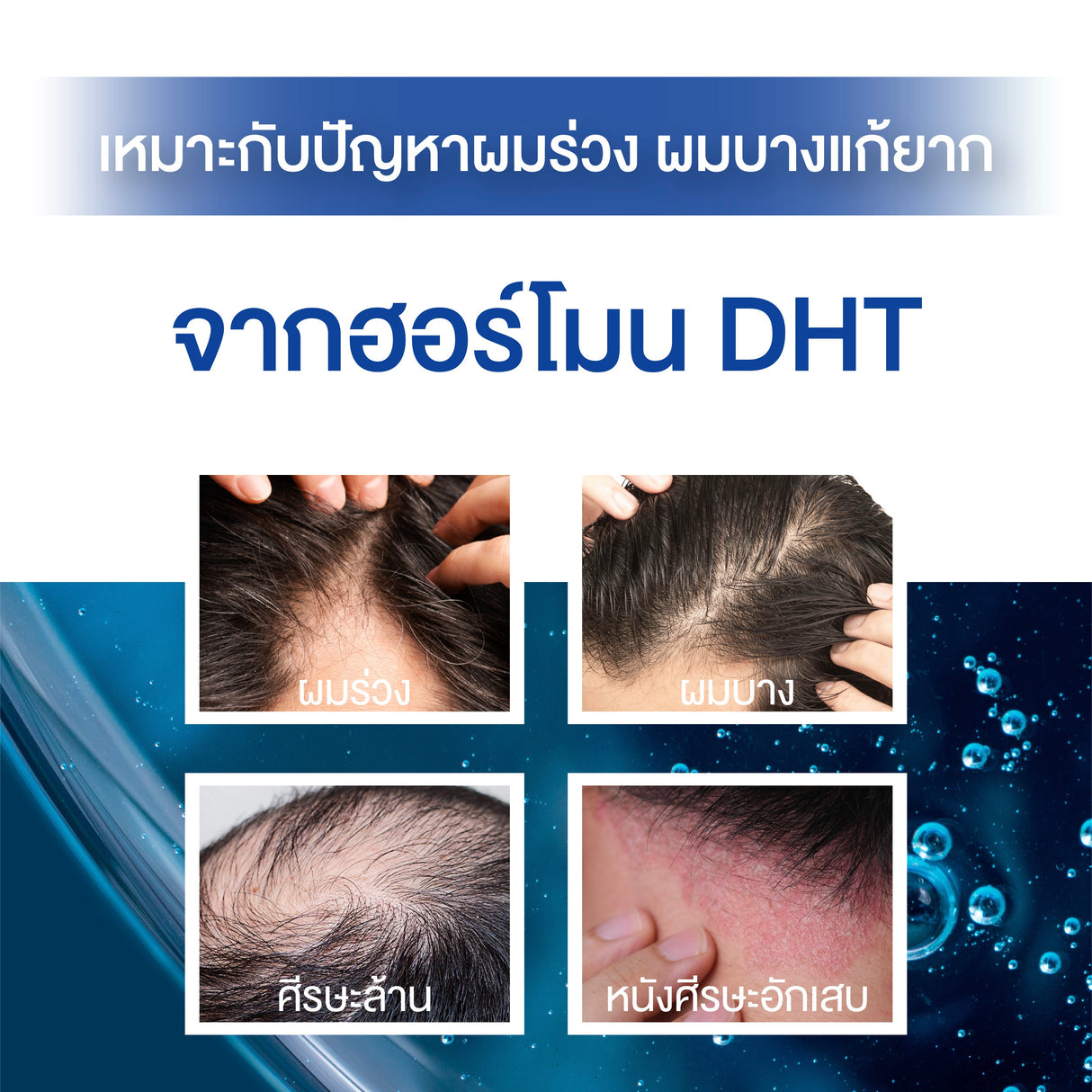 Smooth E Gentlemen Advanced Hair Thickening Anti Hair Loss Serum Spray