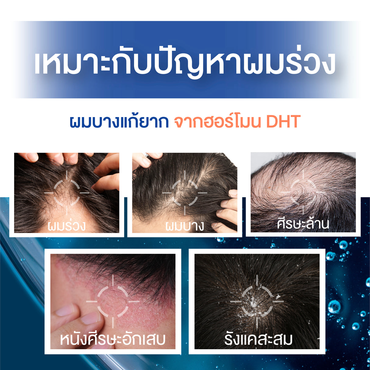 Smooth E Gentlemen Advance Hair Thickening Anti Hair Loss Shampoo