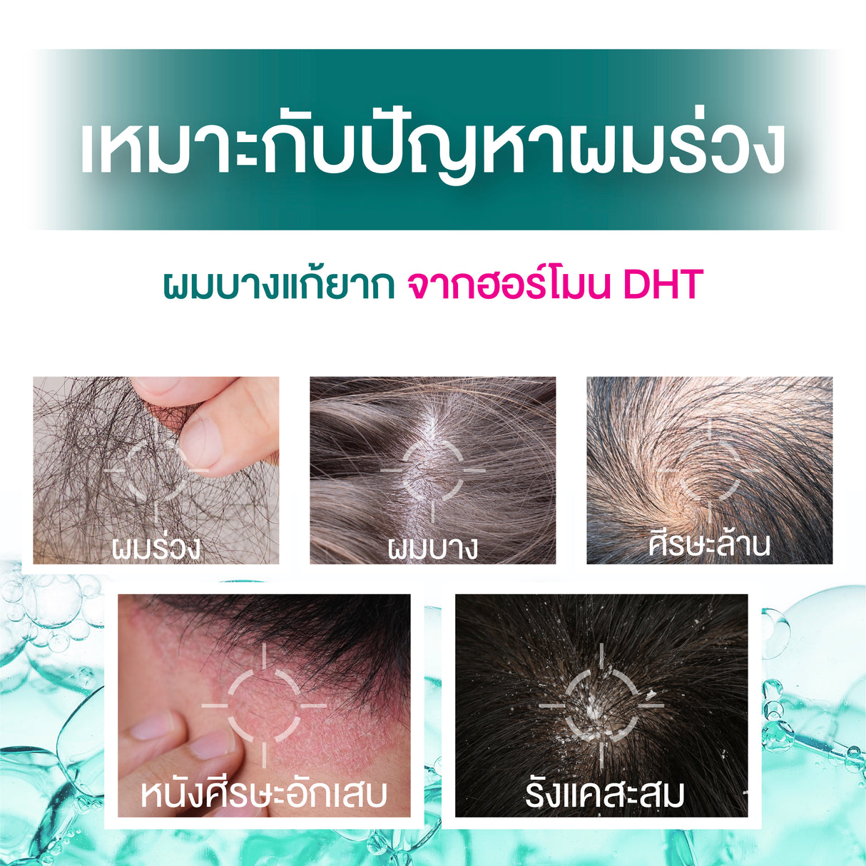 Smooth E Anti Hair Loss Hair Thickening Shampoo