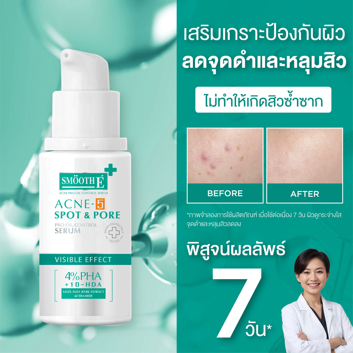 Smooth E Acne-5 SPOT & PORE SERUM
