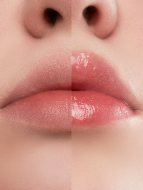 Lips