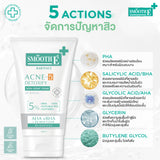 Smooth E Acne-5 Whitening Set