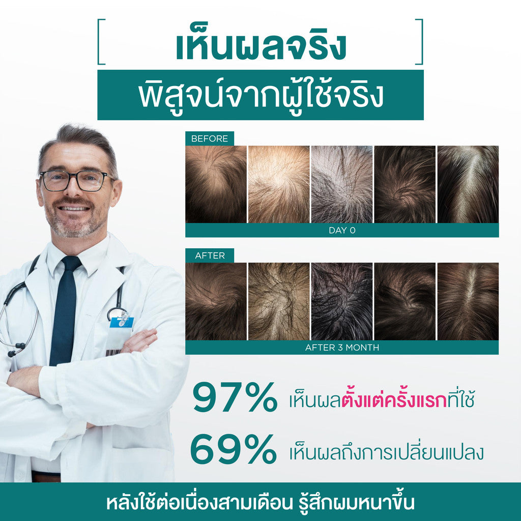 [Duo Deal] mooth E Anti Hair Loss Hair Thickening Serum Spray Free Smooth E Everyday Conditioner