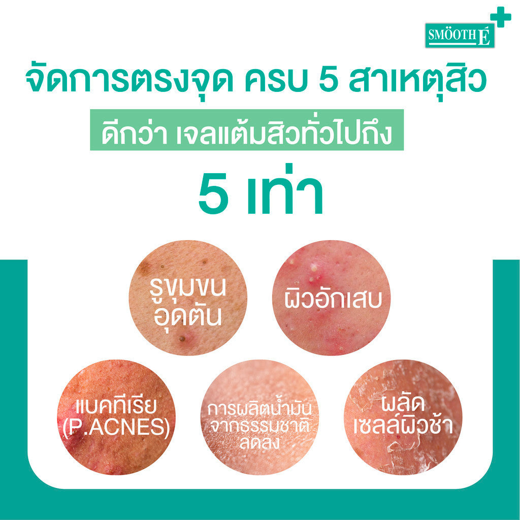Smooth E Anti Acne Rapid Mini เซตดูแลสิว สำหรับผิวมันแพ้ง่าย ลดเลือนรอยดำ สิวอักเสบ