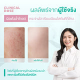 Smooth E White Babyface Spot Clear