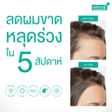 [เซ็ตขายดี] Smooth E Anti Hair Loss Mini Set รักษาและฟื้นบำรุงเส้นผม สำหรับปัญหาผมร่วง รังแค คันศีรษะ ผมมัน สูตรอ่อนโยน