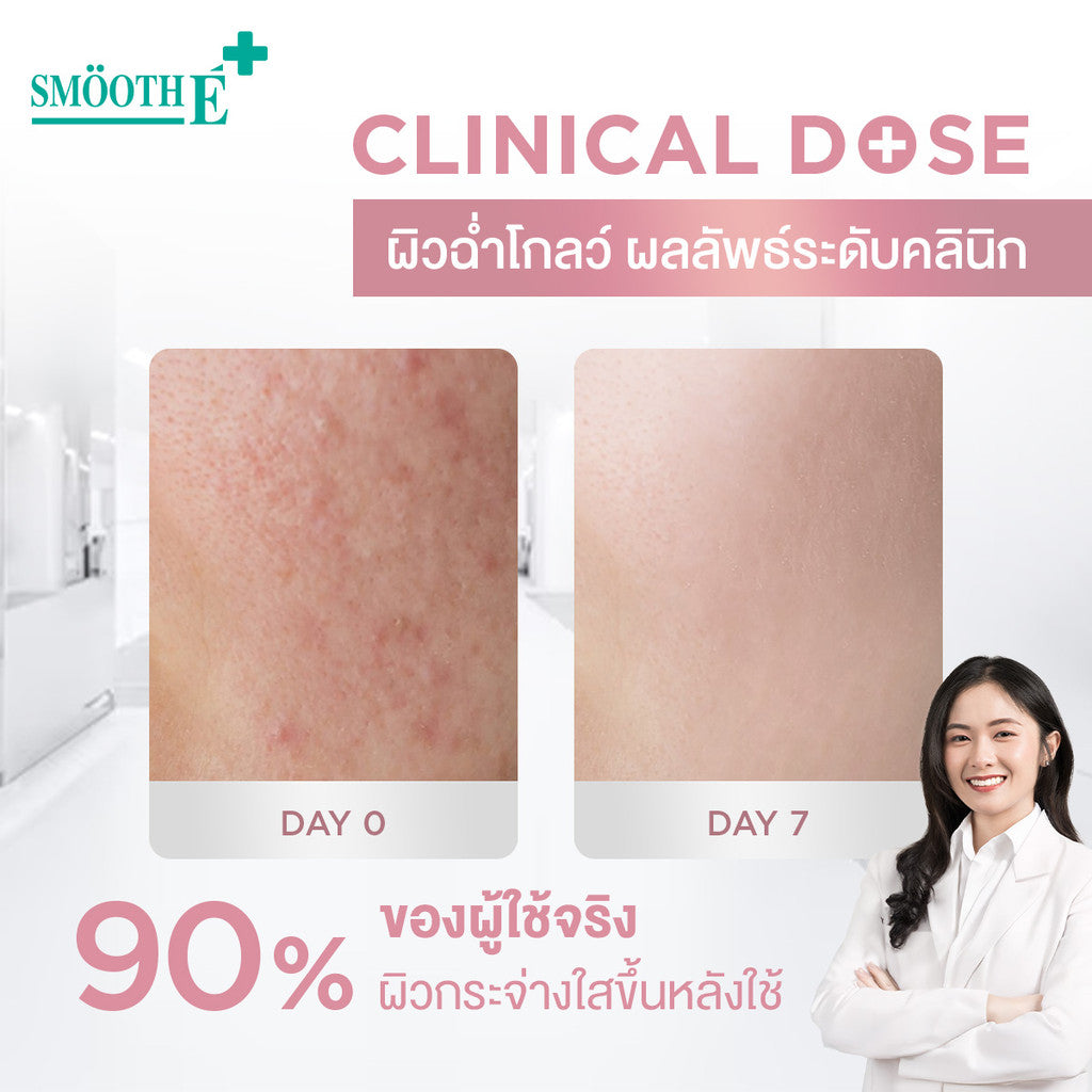 [2 Free 2] Smooth E Sun Asta SPF 50+ PA++++&Smooth E White Babyface Spotclear 80 ml. Free Smooth E Toner 60 ml.&Smooth E Sun Asta Acne 5 g.