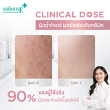 [2 Free 2] Smooth E Sun Asta SPF 50+ PA++++&Smooth E White Babyface Spotclear 80 ml. Free Smooth E Toner 60 ml.&Smooth E Sun Asta Acne 5 g.