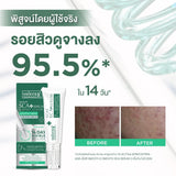 Smooth E SMOOTH SCA SERUM 7 GM.