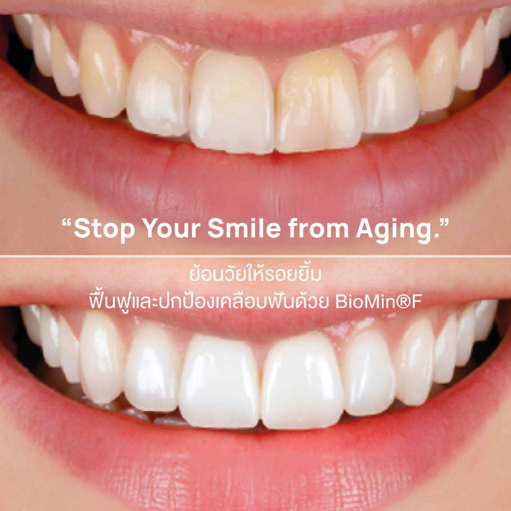 Dentiste’ Remin Biomin Tooth Serum