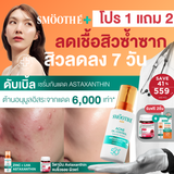 [1 Free 2] Smooth E Sun Asta SPF 50+ PA++++ Free Smooth Life Astaxanthin 6mg 7 capsules &  Smooth E Sun Asta Acne 5 g.