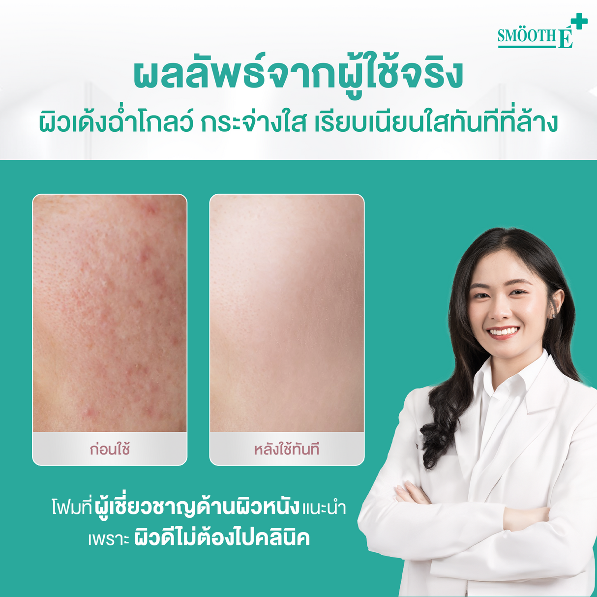 (Deal Duo) Smooth E Clinical Dose Serum 30g. free Smooth E Mineral Spray 100 ml.