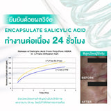 Smooth E Acne-5 Rapid Action Plus