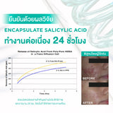 Smooth E Acne-5 Rapid Action
