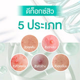 Smooth E Babyface Acne-5 Detoxify Non-Ionic Foam