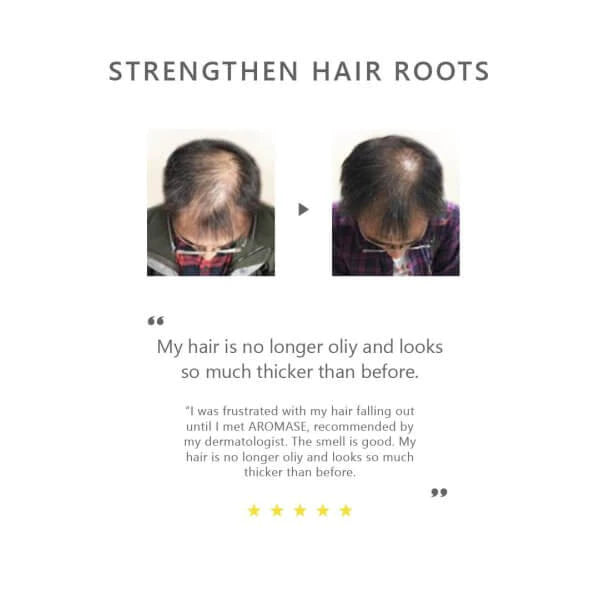 AROMASE Anti-hair Loss Essential Shampoo 400 ml. แชมพูลดผมร่วง เสริมรากผมแข็งแรง บำรุงหนังศีรษะ ขายดีอันดับ 1 ในไต้หวัน