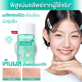 Smooth E Acne-5 Pore Clear Whitening Toner