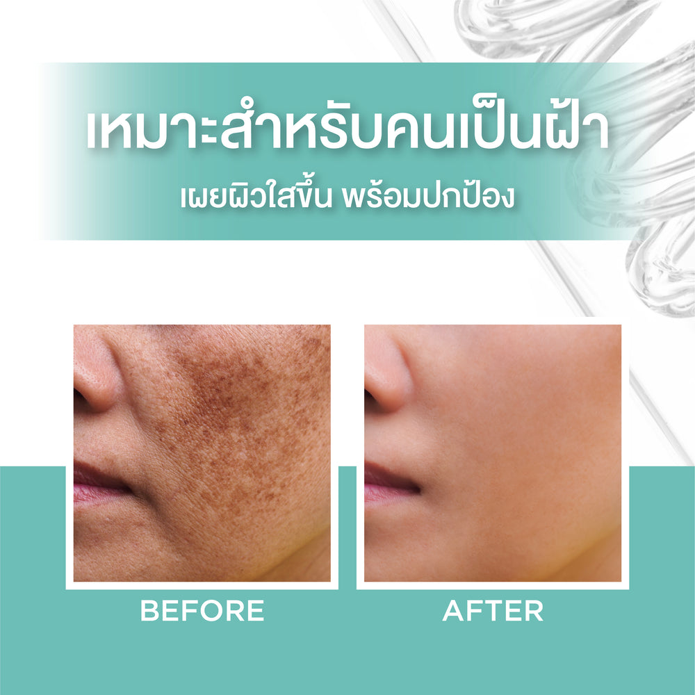 Smooth E Anti-Melasma White Babyface Serum Plus SPF44