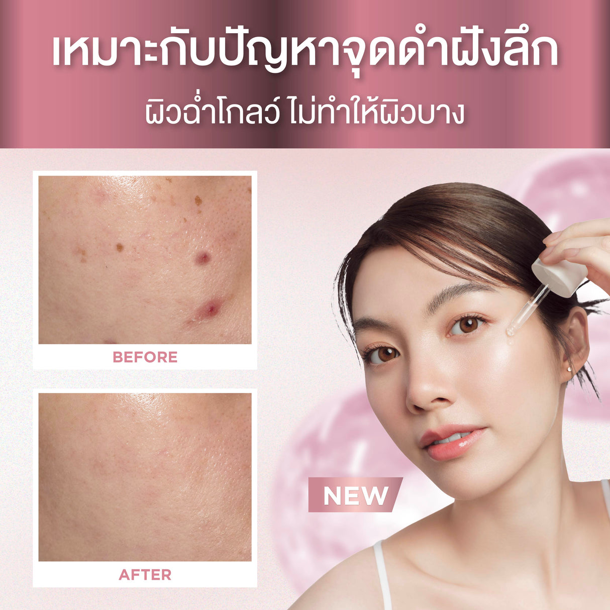 [Duo Deal] Smooth E Sun ZERO Feel Protection 30 g. & Smooth E Serum 13 g.