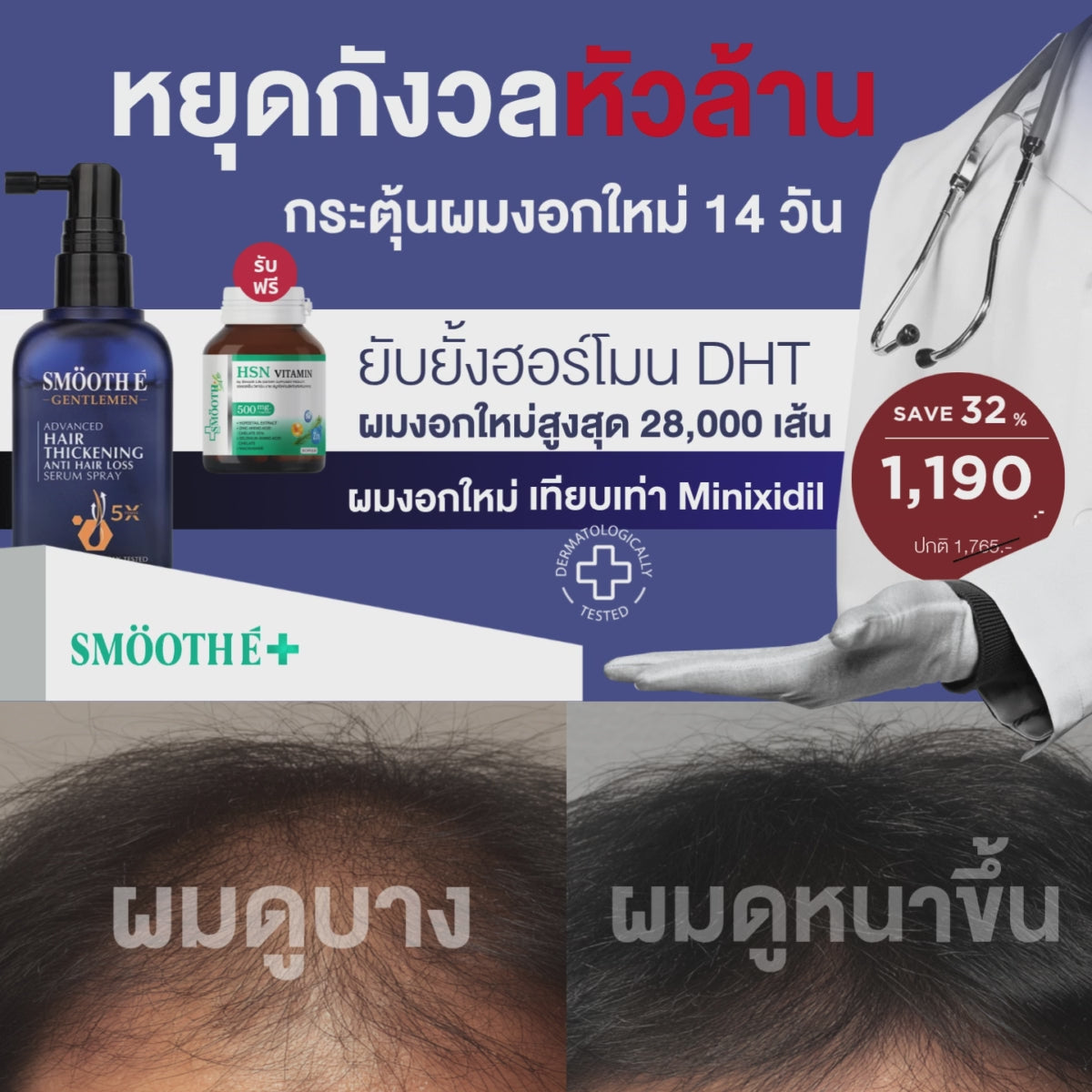 [1 Free 1] Smooth E Gentlemen Anti Hair Loss Serum Spray 50 ml. Free Smooth Life HSN Vitamin 7 tab