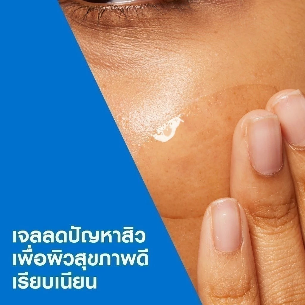 CERAVE BLEMISH CONTROL GEL เซราวี ผลิตภัณฑ์บำรุงผิวหน้า สูตรสำหรับผิวเป็นสิวง่าย 40 มล.